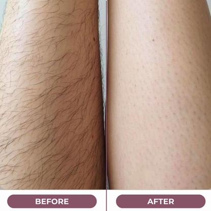 SilkSnip™ Trimmer